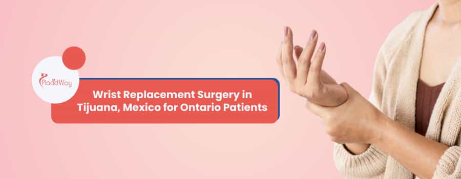 Wrist Replacement Surgery in Tijuana, Mexico for Ontario Patients