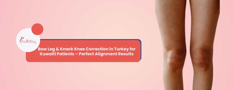 Knock Knee Correction in Turkey