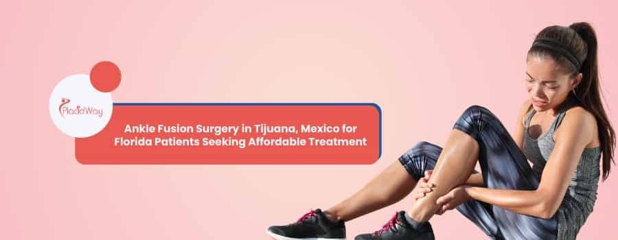 Ankle Fusion Surgery in Tijuana, Mexico