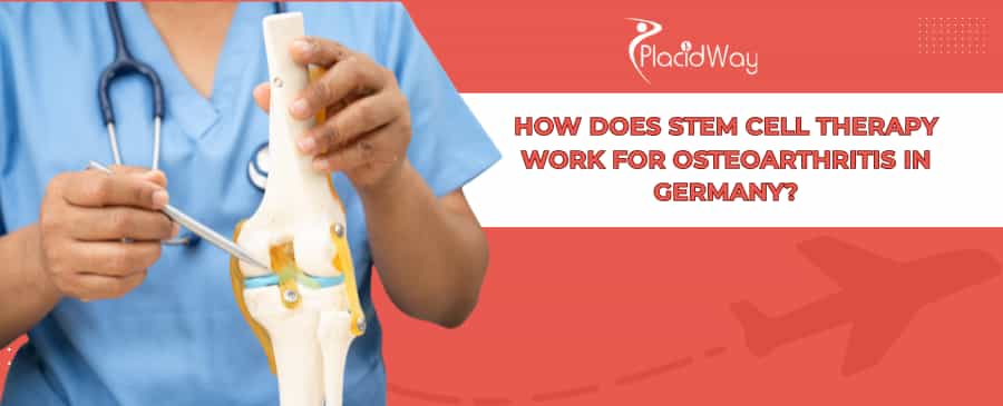 Stammzellentherapie bei Arthrose in Deutschland