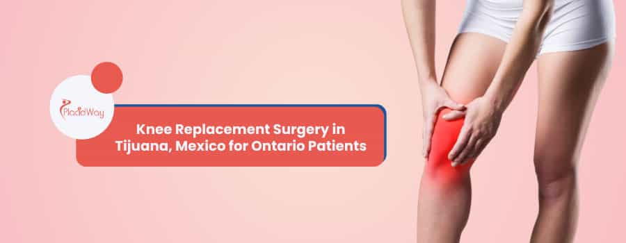 Knee Replacement Surgery in Tijuana, Mexico for Ontario Patients