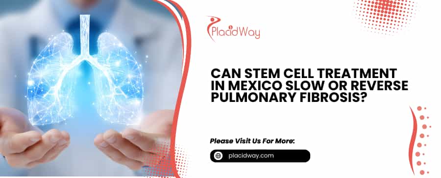 Stem Cell Treatment in Mexico 