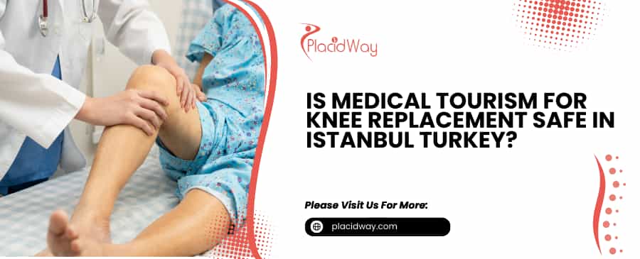 Knee Replacement in Istanbul Turkey