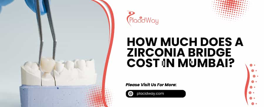 Zirconia Bridge Cost in Mumbai