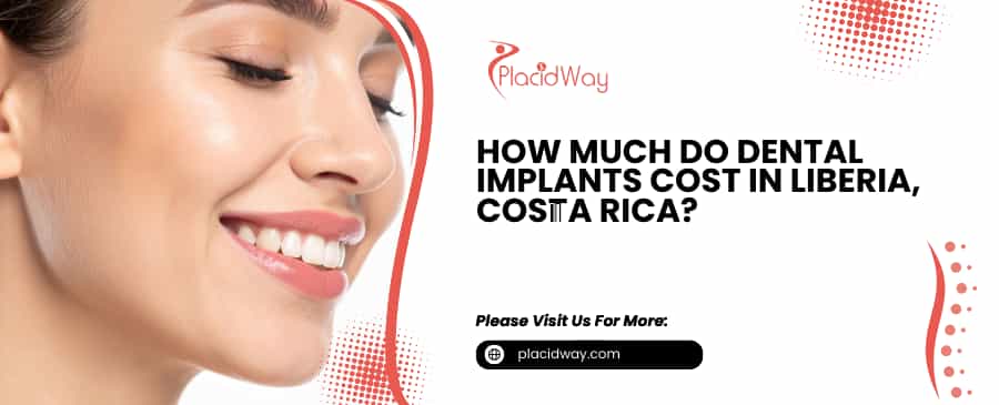 Costo de implantes dentales en Liberia, Costa Rica
