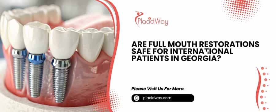 Full Mouth Restorations for International Patients in Georgia