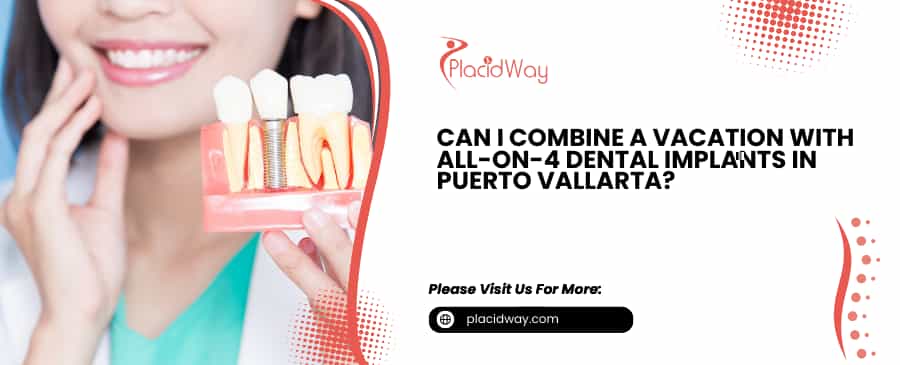 Implantes dentales All-on-4 en Puerto Vallarta
