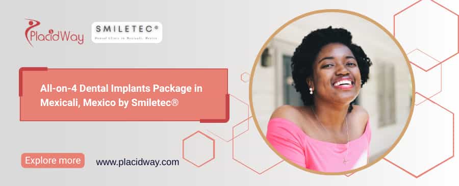 Paquete de implantes dentales All-on-4 en Mexicali: una solución para tu sonrisa a un precio accesible
