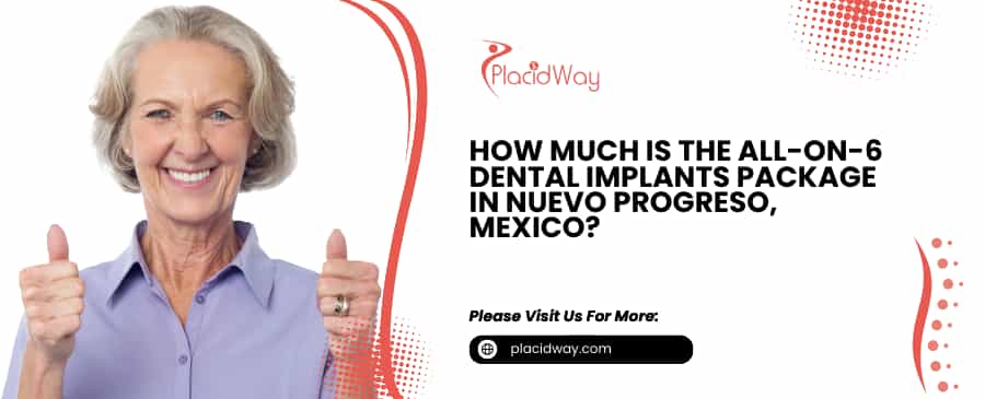 Paquete de 6 implantes dentales en Nuevo Progreso, México