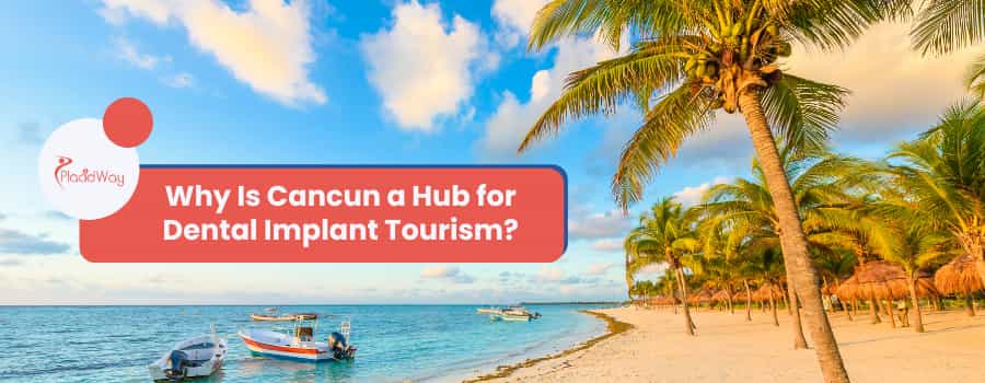 ¿Por qué Cancún es un centro para el turismo de implantes dentales?