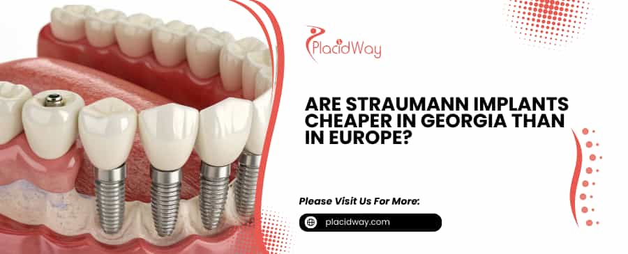 Straumann Implants Cheaper in Georgia
