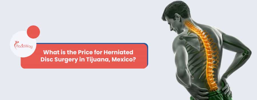 ¿Cuál es el precio de una cirugía de hernia de disco en Tijuana, México?