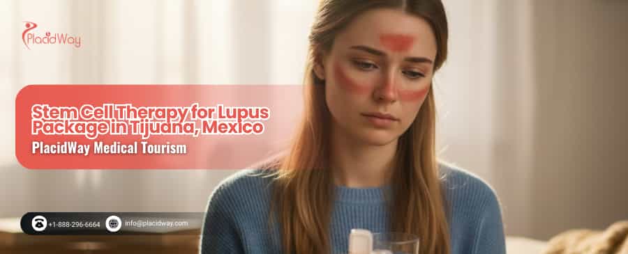 Terapia con células madre para el lupus en Tijuana, México