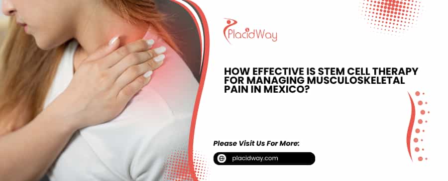 Stem Cell Therapy for Managing Musculoskeletal Pain in Mexico