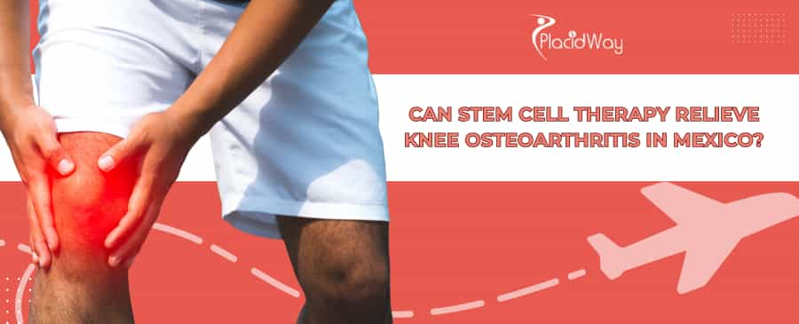 Terapia con células madre para la osteoartritis de rodilla en México