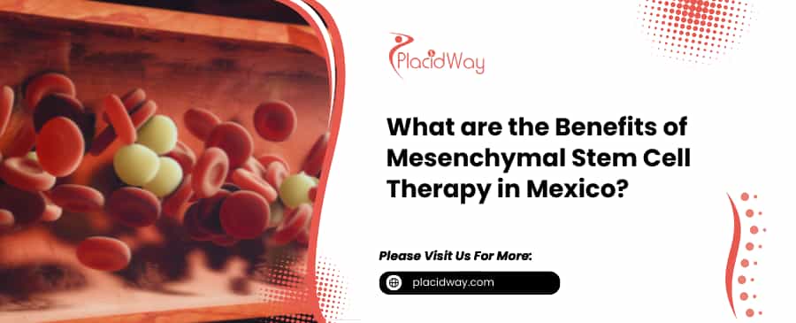 Mesenchymal Stem Cell Therapy in Mexico