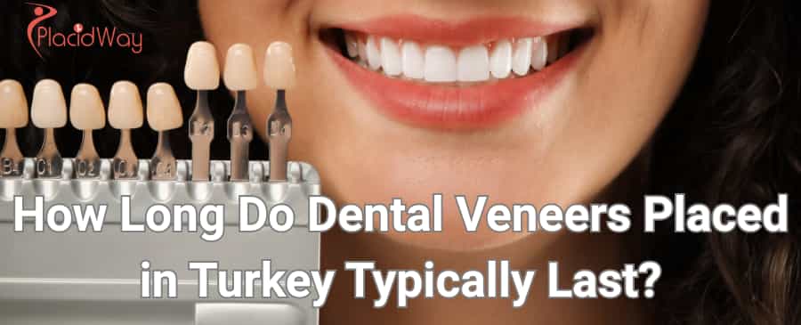 dental veneers in turkey