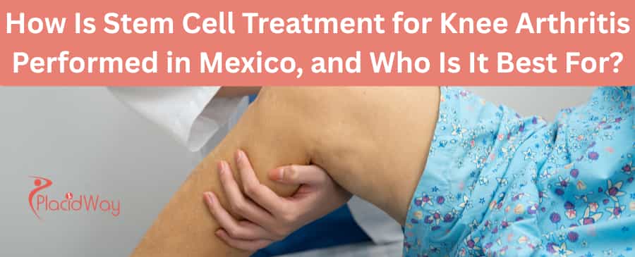 stem cell treatment for knee arthritis