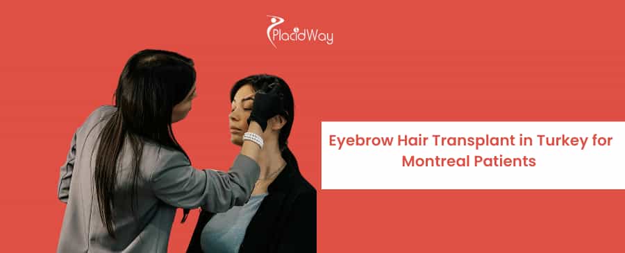 Eyebrow Hair Transplant in Turkey