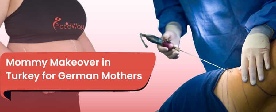 Mommy Makeover in Turkey
