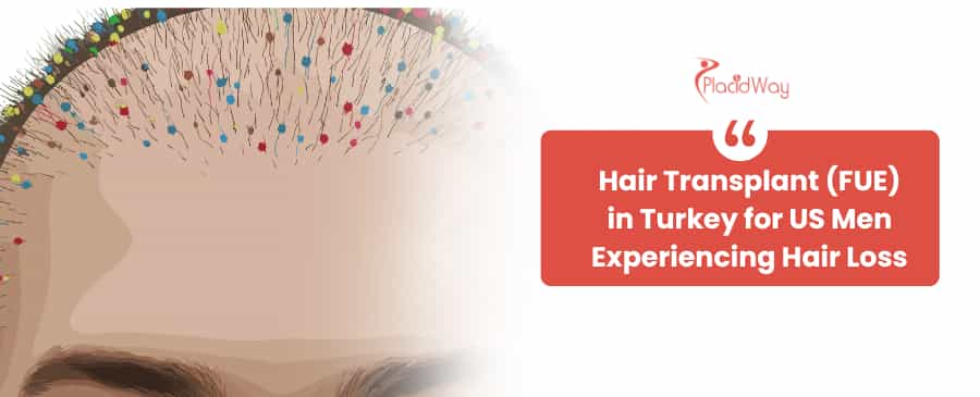 Hair Transplant (FUE) in Turkey 