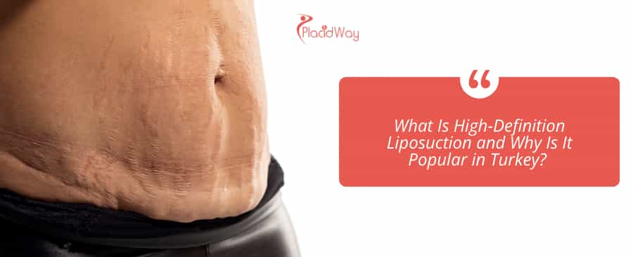 High-Definition Liposuction