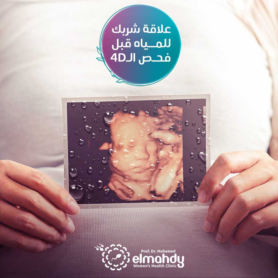 IVF in Ägypten - Dr. Mohamed El Mahdy
