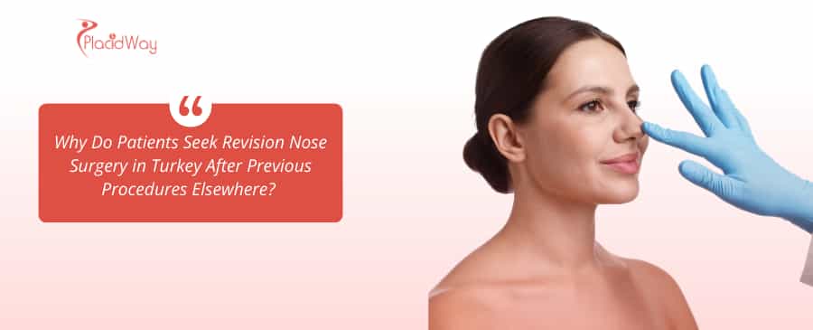 Revision Nose Surgery in Turkey