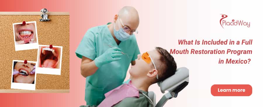 Full Mouth Restoration Program in Mexico
