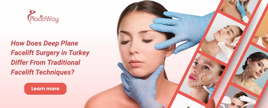Facelift Surgery in Turkey