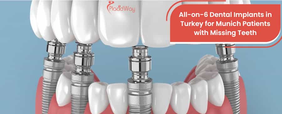 All-on-6 Dental Implants in Turkey