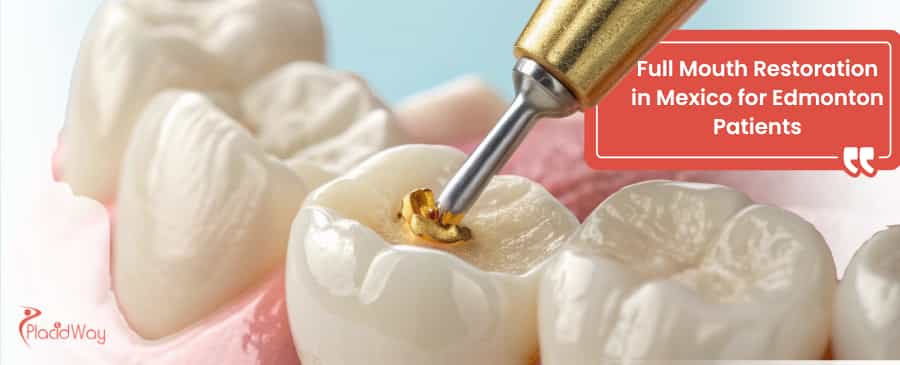 Full Mouth Restoration in Mexico