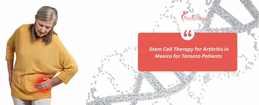 Stem Cell Therapy for Arthritis in Mexico