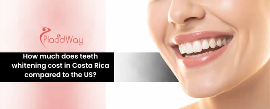 teeth whitening in Costa Rica