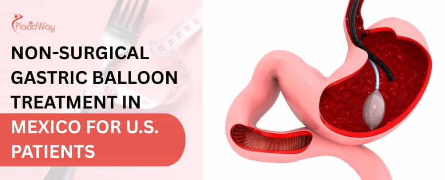 Non-Surgical Gastric Balloon Treatment in Mexico for U.S. Patients