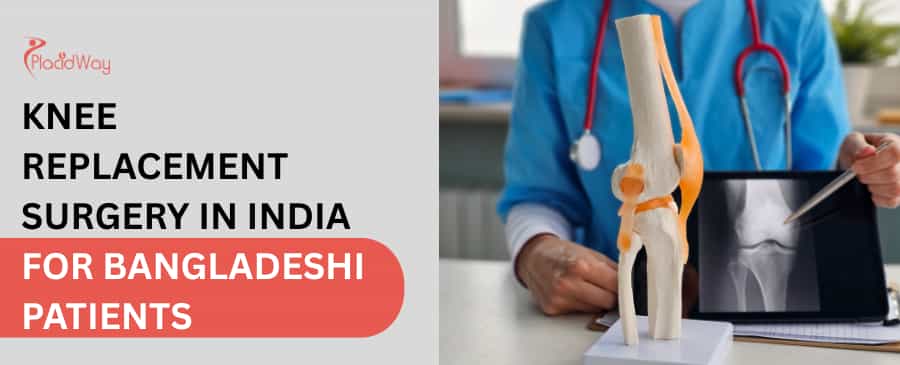 Knee Replacement Surgery in India for Bangladeshi Patients