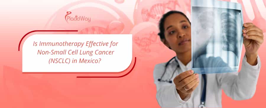 Is Immunotherapy Effective for Non-Small Cell Lung Cancer (NSCLC) in Mexico? 