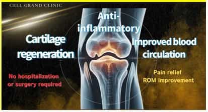 Knee Stem Cells Japan