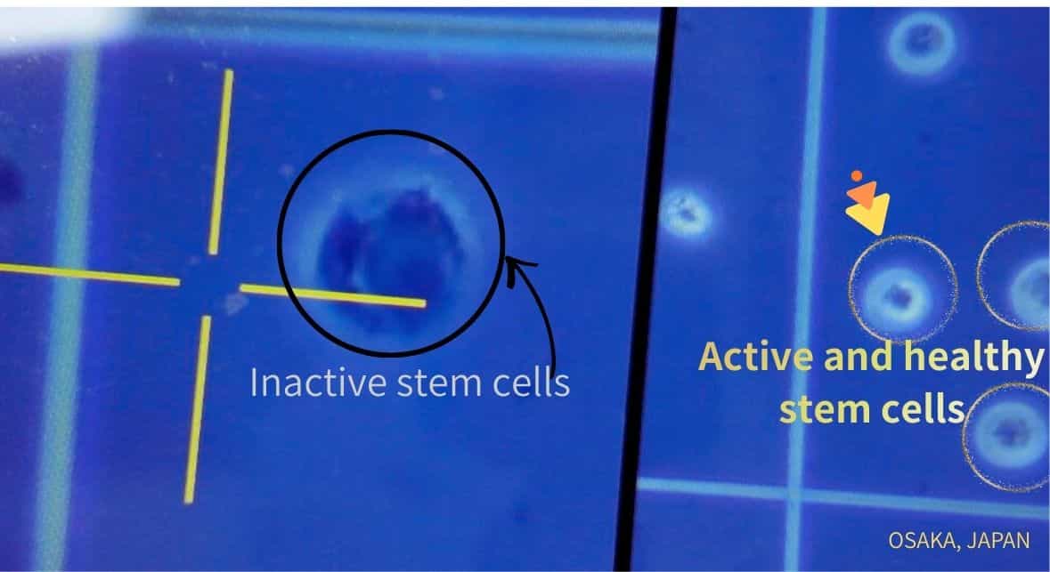 الخلايا الجذعية في اليابان