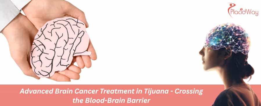 Tratamiento avanzado del cáncer cerebral en Tijuana