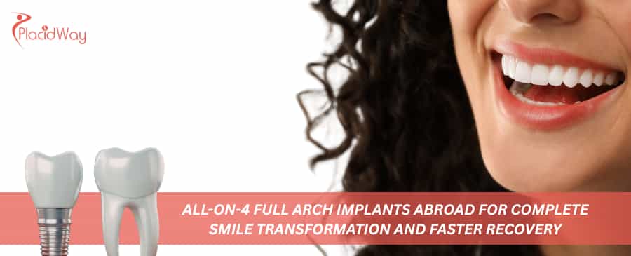 Implantes de arco completo All-on-4 en el extranjero para una transformación completa de la sonrisa y una recuperación más rápida
