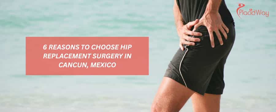 6 razones para elegir la cirugía de reemplazo de cadera en Cancún, México