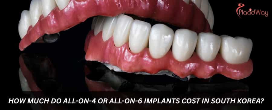 How much do All-on-4 or All-on-6 implants cost in South Korea?