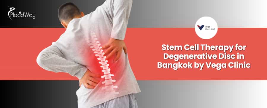 Терапия стволовыми клетками при дегенеративных заболеваниях межпозвоночных дисков в клинике Vega в Бангкоке.