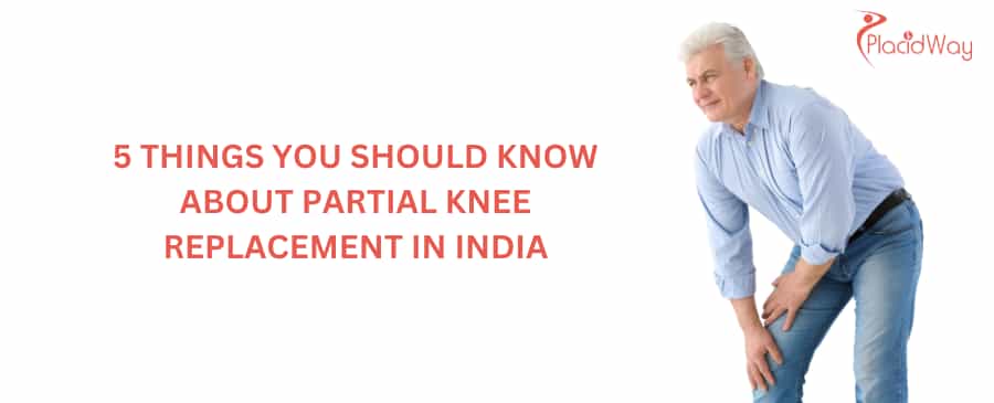 5 Things You Should Know About Partial Knee Replacement in India