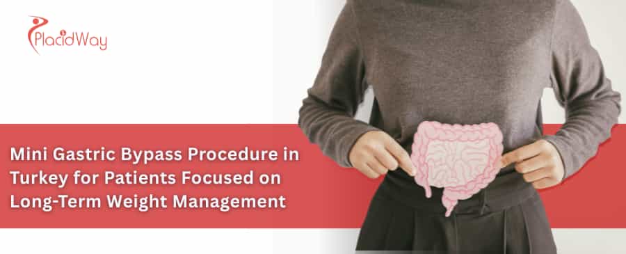 Mini Gastric Bypass Procedure in Turkey for Patients Focused on Long-Term Weight Management