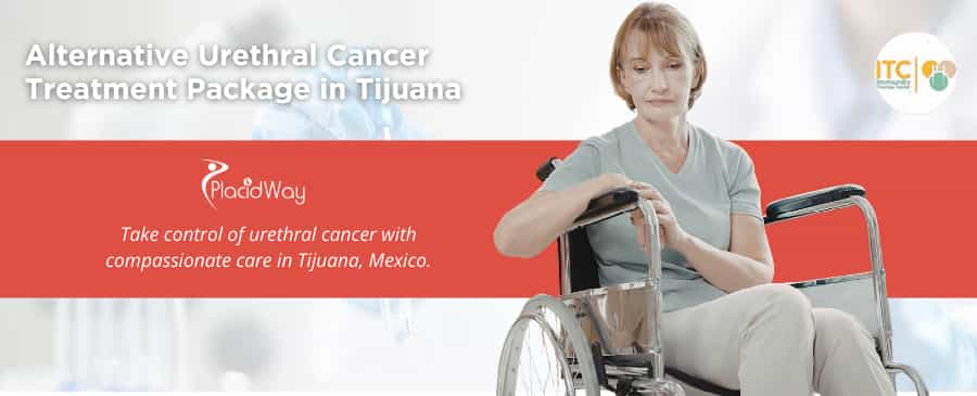 Alternative Urethral Cancer Treatment Package in Tijuana, Mexico by ITC
