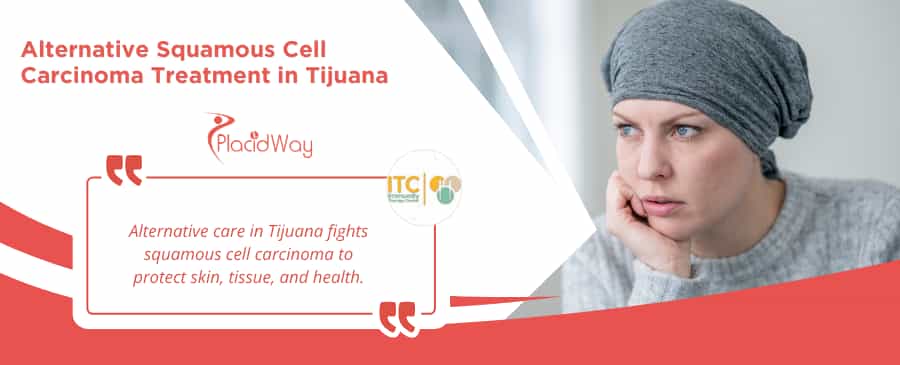 Alternative Squamous Cell Carcinoma Treatment Package in Tijuana, Mexico by ITC