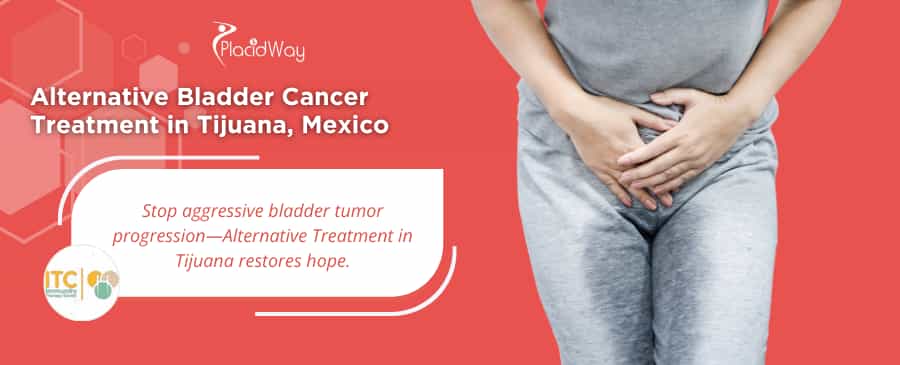 Alternative Bladder Cancer Treatment Package in Tijuana, Mexico by ITC