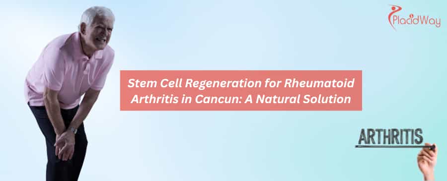 Regeneración con células madre para la artritis reumatoide en Cancún